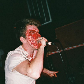 Glue